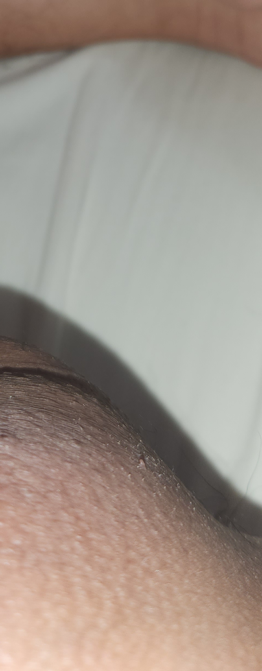 1000004642.jpg